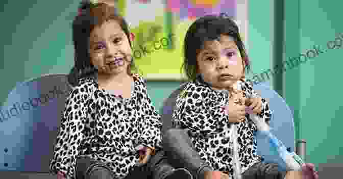 Hope And Faith, Conjoined Twins, One Year After Separation Little Fighters: Miracle Conjoined Twins: One Year On